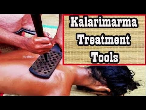 Tool therapy segment in Kalari marma therapy -  Chikilsa Part 1 (Duration: 03:38:38)